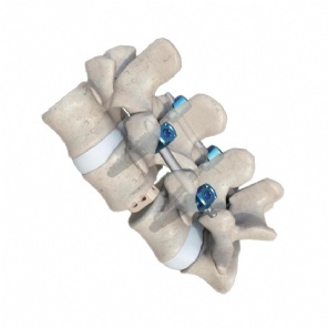 Pedicle Screws Kits II